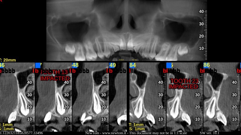 CBCT – Sai Disha Diagnostics
