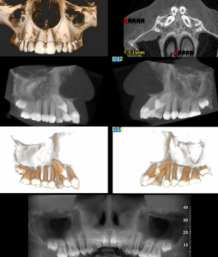 cbct_g