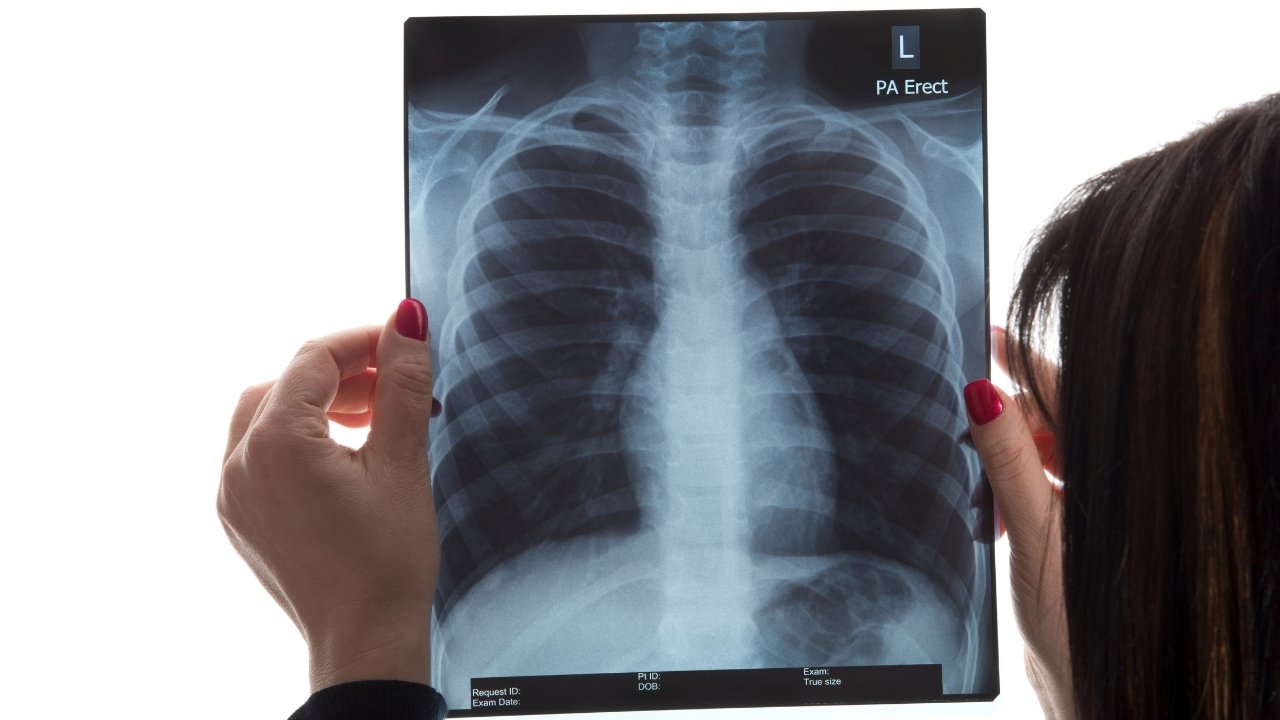 x-ray_banner_new