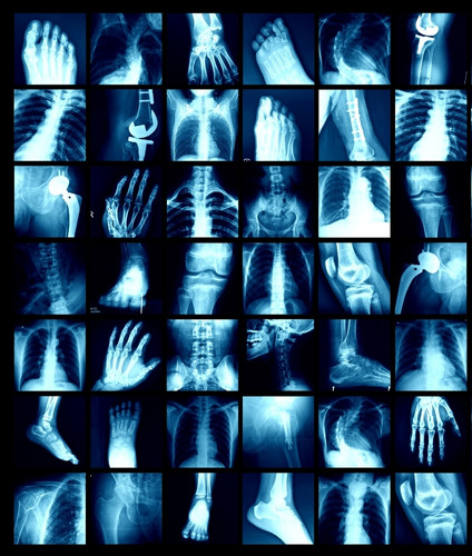 x-ray_gallery